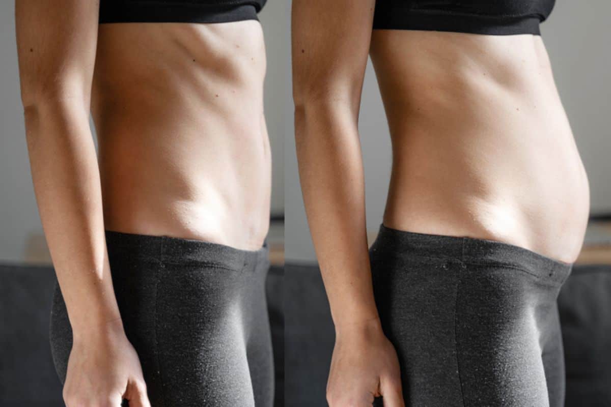 How long does diastasis recti take to improve Scunthorpe?