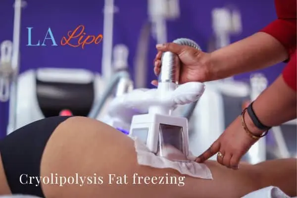 women getting fat freezing Scunthorpe