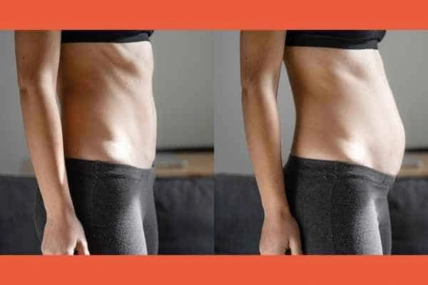 LA-EMS Body Sculpting results Scunthorpe