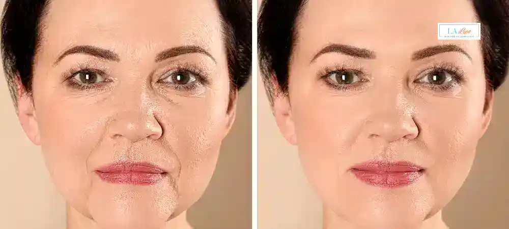 Why Aren’t My Skincare Products Making My Sagging Skin Look Firmer Scunthorpe?